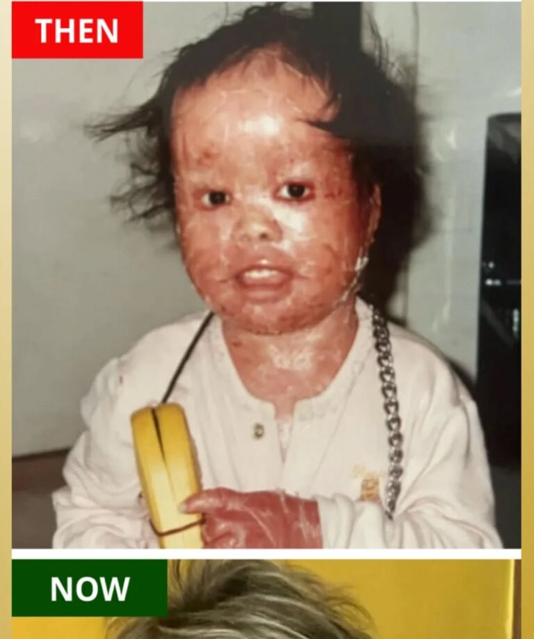 A couple decides to adopt a baby with red skin who seemed to have a little chance of survival and raises her to become a true champion…